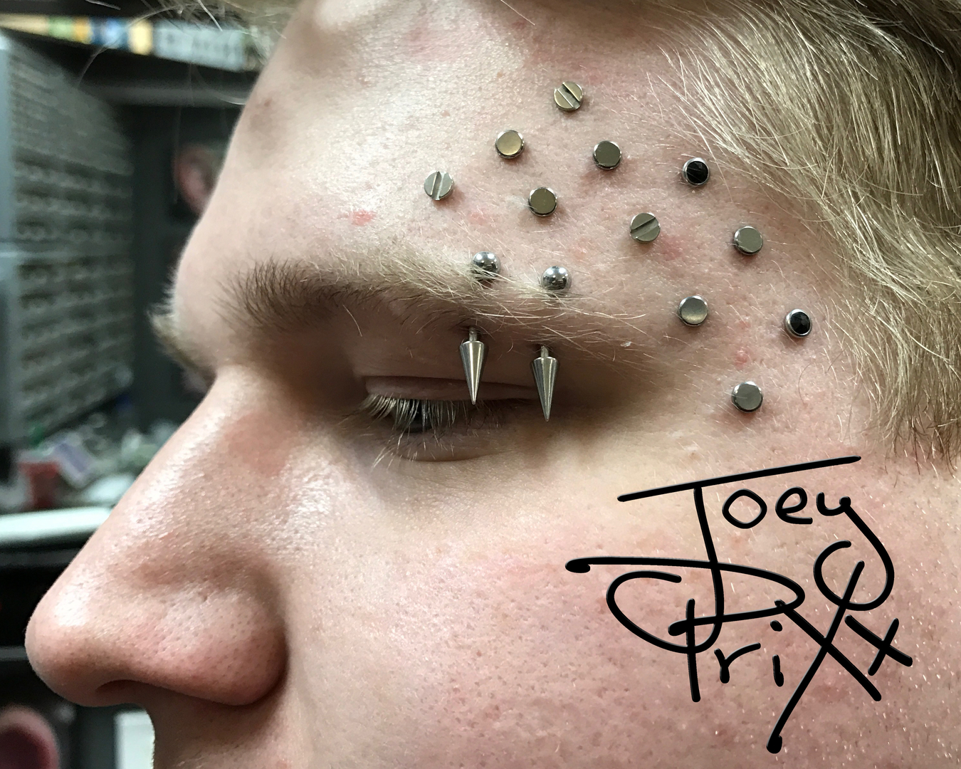 Custom shop dermal tops