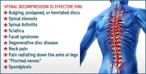 Degenerative Disc Disease  Spinal Decompression Livermore