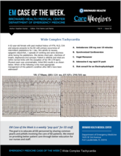 Wide Complex Tachycardia, Kaydian Hunter