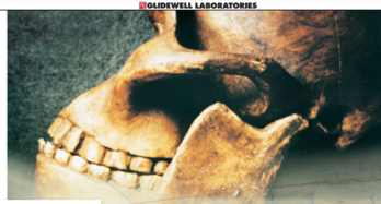 Teeth wear on pre historic ancestors