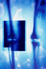 HOME X-RAY AND ULTRASOUND