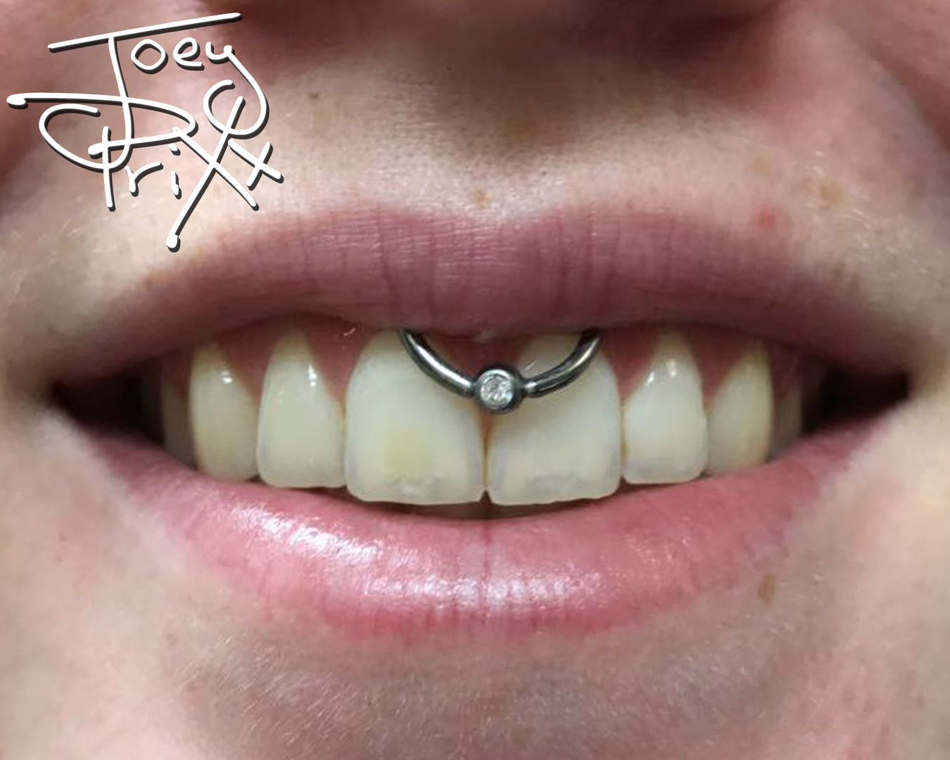 upper frenulum piercing