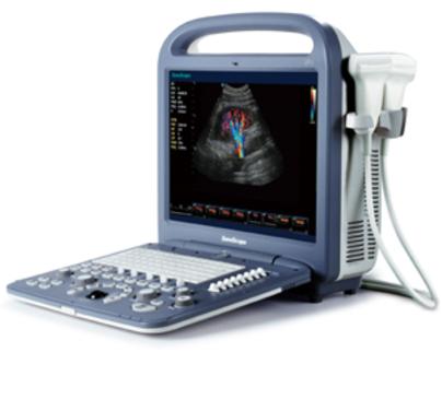 S2 SonoScape Ultrasound Machine