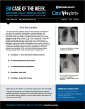 Viral Pericarditis, Reem Itani