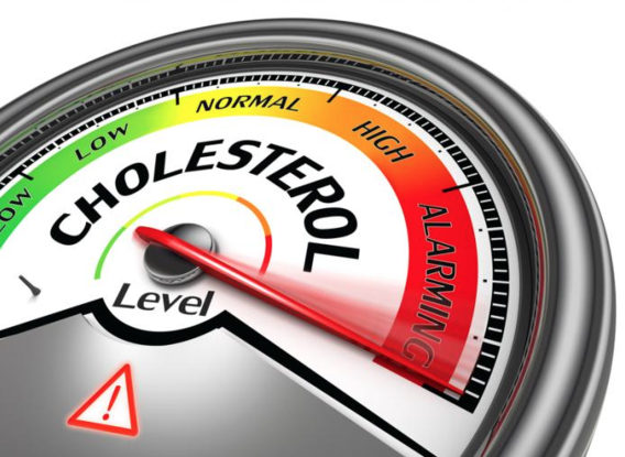 Cholesterol Levels - Dr. Joel Wallach