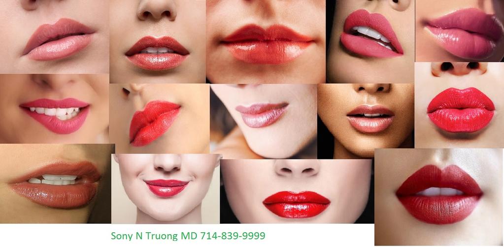 Botox Fountain Valley Ca 8 unit