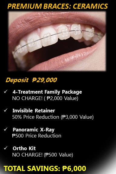 Braces Cost - Dentram Dental Clinics