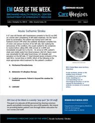 stroke, ischemic, acute stroke, EM, Christopher Do