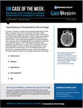 Intracerebral hemorrhage, ICH, Brian Baird