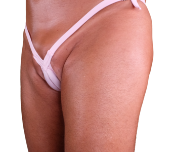Transgender Swimsuit