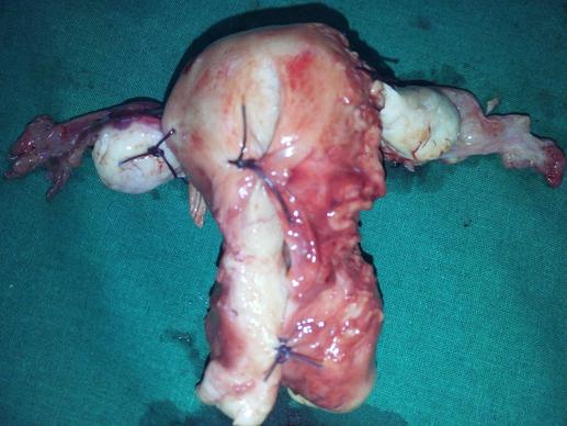 best uterus removal surgeon panjim