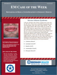 0915 -3 Stevens Johnsons Syndrome (written by Alisa Hussain, MSIV)