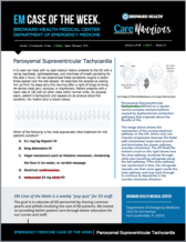 PSVT, SVT, supraventricular tachycardia, Chris Kinter