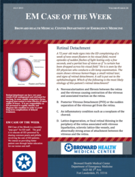 0715 -3 Retinal Detachment (written by Priya Panera, MSIV)