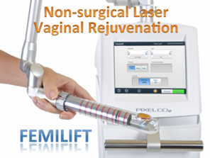 Femilift nonsurgical laser vaginal rejuvenation