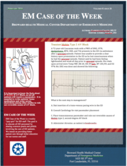 0216 -4 Second degree AV Heart Block (written by Gabrielly Coatti, MSIV)