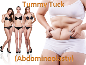 Abdominoplasty Tummy Tuck Liposuction