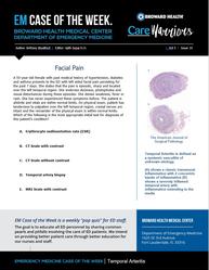 temporal arteritis, giant cell arteritis, brittany woolford, em