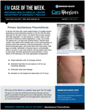 Pneumothorax, Reem Ichoa