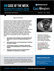 Sigmod Diverticulitis, Ryan Gluth