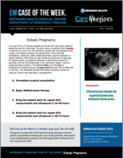 ectopic pregnancy, rebecca hunt