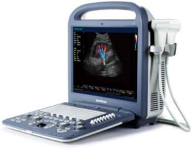 Sonoscape S2 Ultrasound Machine