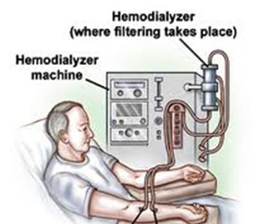 What Is Dialysis