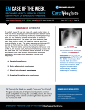 Boerhaave's Syndrome, Ashkahn Zomorrodi, esophageal rupture