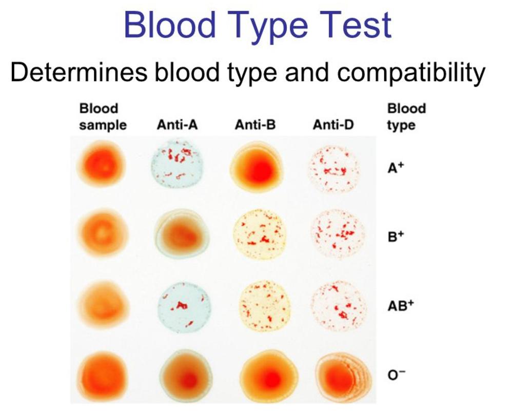 211lab-bloodtypetesting-paternity