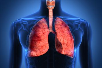 imagen digital pulmones