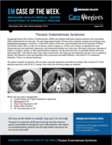 thoracic endometriosis syndrome, daniel samet, catamenial pneumothorax