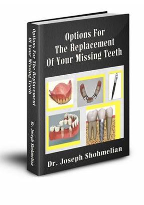 ebook "Options For The Replacement Of Missing Teeth"