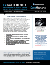 HOCM, HCM, Hypertrophic Cardiomyopathy, Garrett Van Ostran