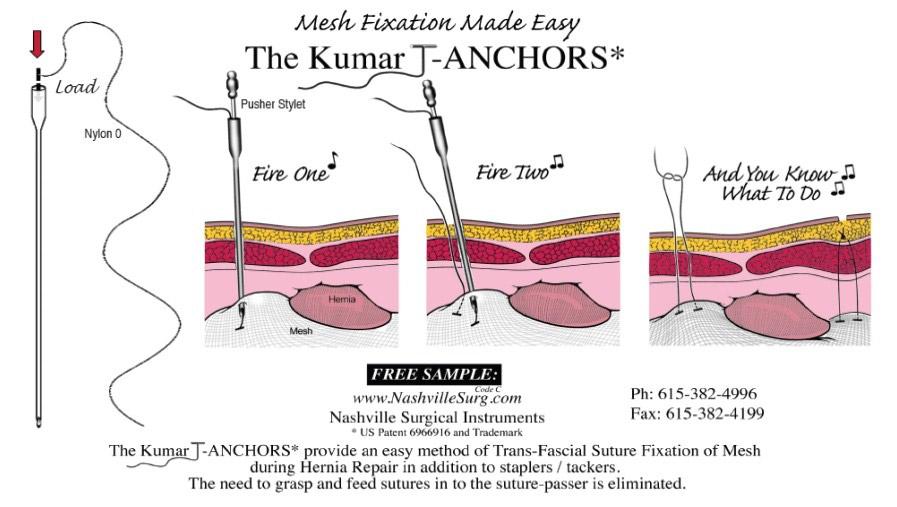 Operative surgery . How to do it. How not to do it. Fig. 137.—Tension while  sewing. Fig. 138.Tension of sutures. main in situ is governed by the  liability to ulceration and disfigurement