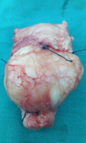best uterus removal surgeon margao