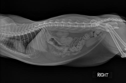 Demonstration Abdoman Xray