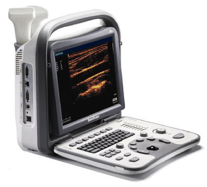 Sonoscape A6 Ultrasound Machine