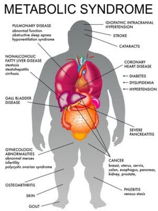 Metabolic syndrome and risk factors; obesity, insulin resistance, hypertension and cancer