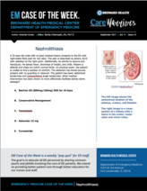 kidney stones, nephrolithiasis, amanda hunter