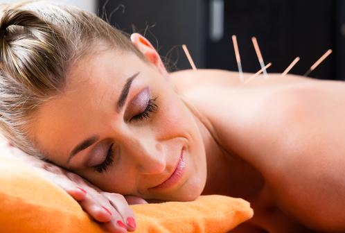 Female, eyes closed, light brown hair pulled back, enjoying acupuncture needles inserted in her back as she lays on her right cheek, face down on orange pillow