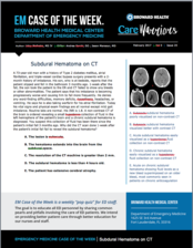 Subdural Hematoma, Uday Malhotra