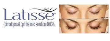 Latisse Price Cost Orange County Struong Cosmetic