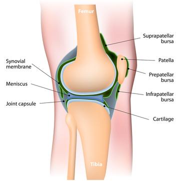 Knee Osteoarthritis