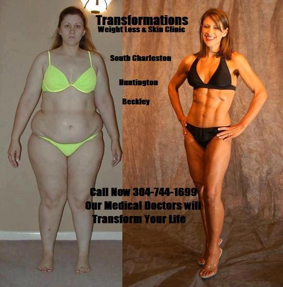 Charleston Wv Weight Loss Center