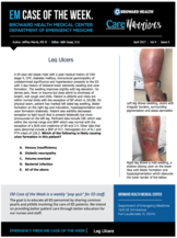 leg ulcers, jeffrey morris