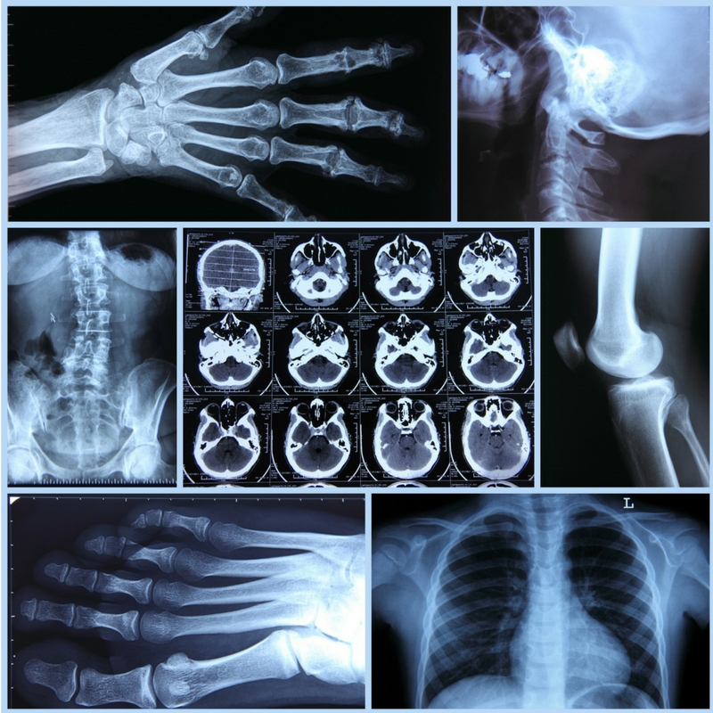 Arthritis And Rheumatology Centre Arthritis, Rheumatology, Doctors