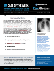 1116 -3 Boorhaeve's Syndrome (written by Ariel Lee, MSIV)