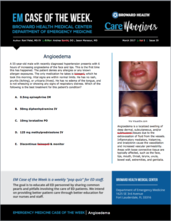 Angioedema, Ravi Patel