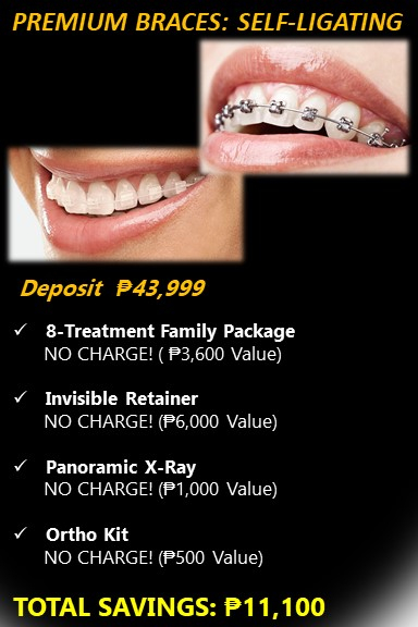 Braces Cost: Your Guide to Affordable Orthodontic Treatment Expenses