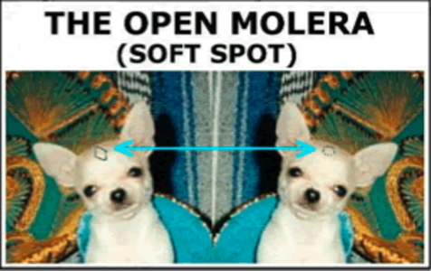 Molera Soft Spot